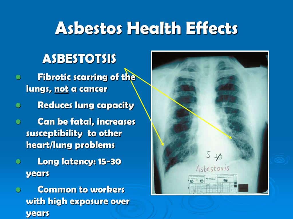 The Dangers of Asbestos in Older Homes
